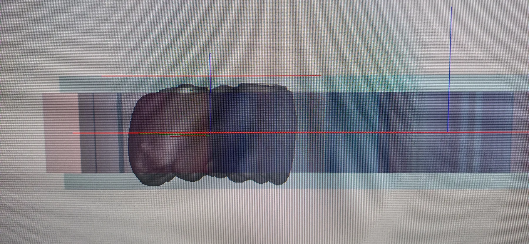 Digitális fogtechnikai tervezés